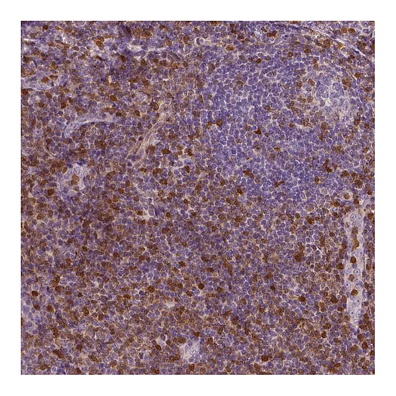 Atlas Antibodies Anti-S100A4 Antibody