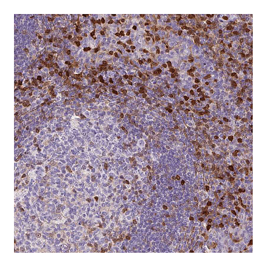 Atlas Antibodies Anti-S100A4 Antibody