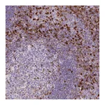 Atlas Antibodies Anti-S100A4 Antibody