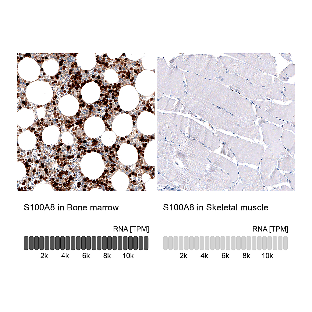 Atlas Antibodies Anti-S100A8 Antibody