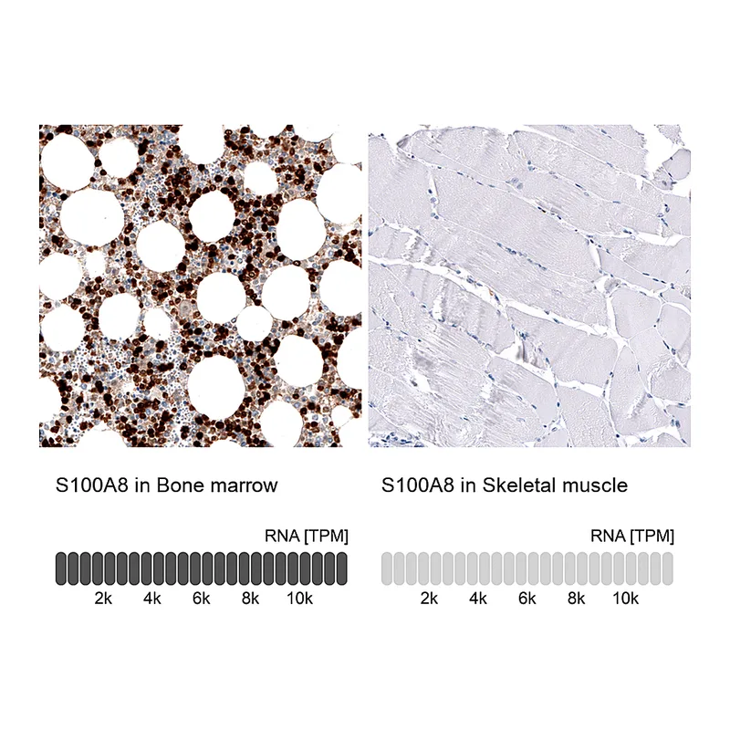 Atlas Antibodies Anti-S100A8 Antibody