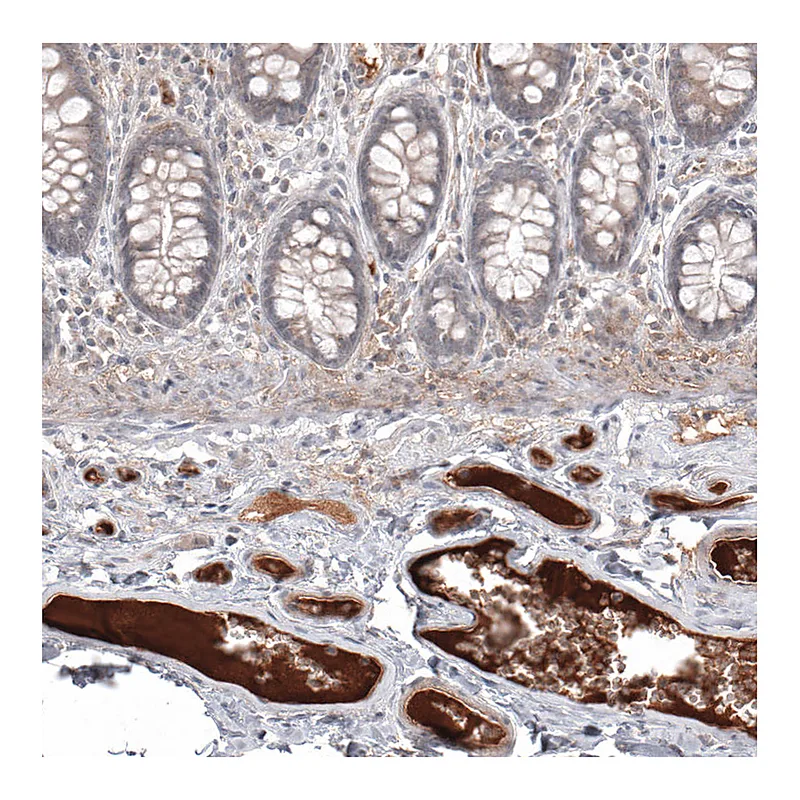Atlas Antibodies Anti-SAA1 Antibody