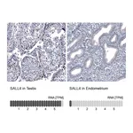 Atlas Antibodies Anti-SALL4 Antibody