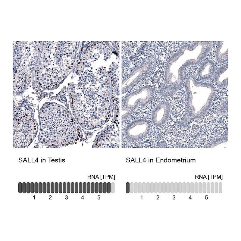 Atlas Antibodies Anti-SALL4 Antibody