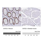 Atlas Antibodies Anti-SATB2 Antibody