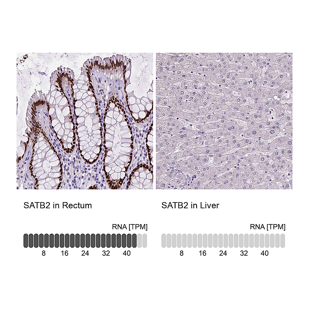 Atlas Antibodies Anti-SATB2 Antibody