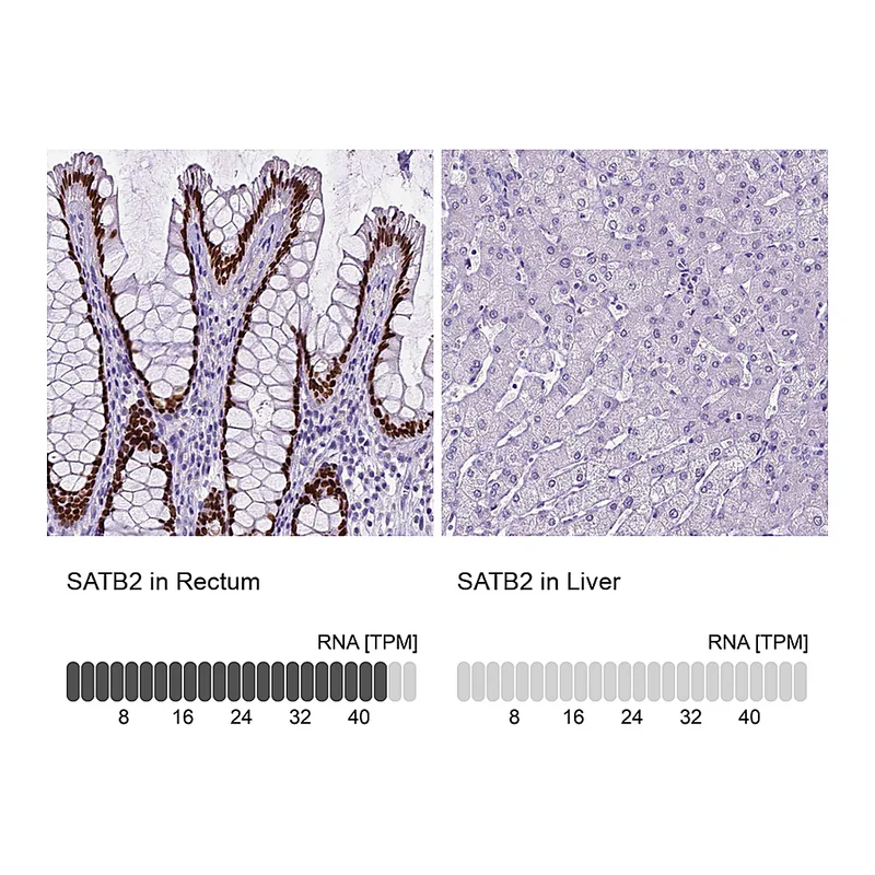 Atlas Antibodies Anti-SATB2 Antibody
