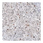 Atlas Antibodies Anti-SCGB2A2 Antibody