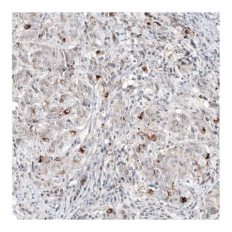 Atlas Antibodies Anti-SCGB2A2 Antibody