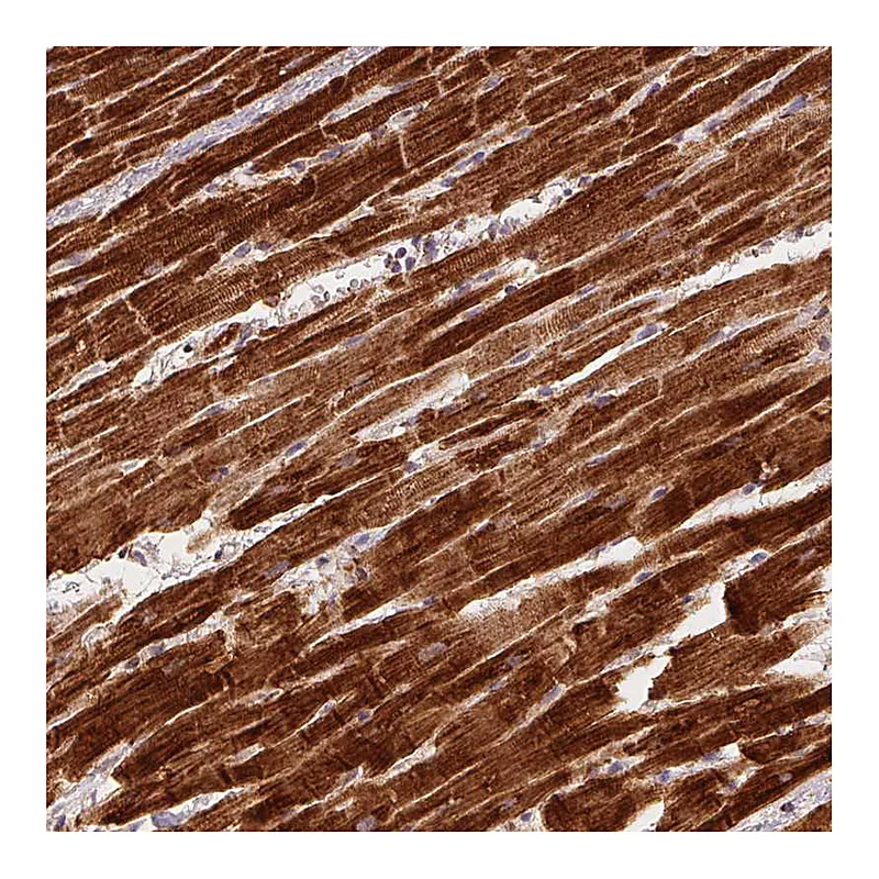 Atlas Antibodies Anti-SDHB Antibody