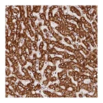 Atlas Antibodies Anti-SDHB Antibody
