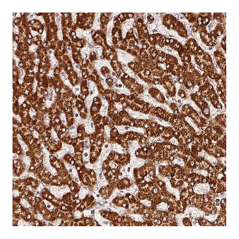 Atlas Antibodies Anti-SDHB Antibody