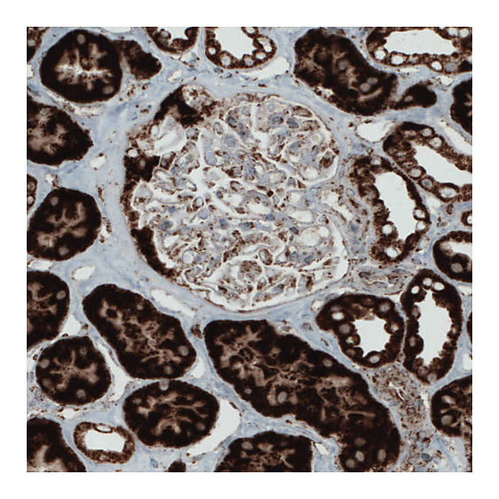 Atlas Antibodies Anti-SDHB Antibody