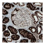Atlas Antibodies Anti-SDHB Antibody