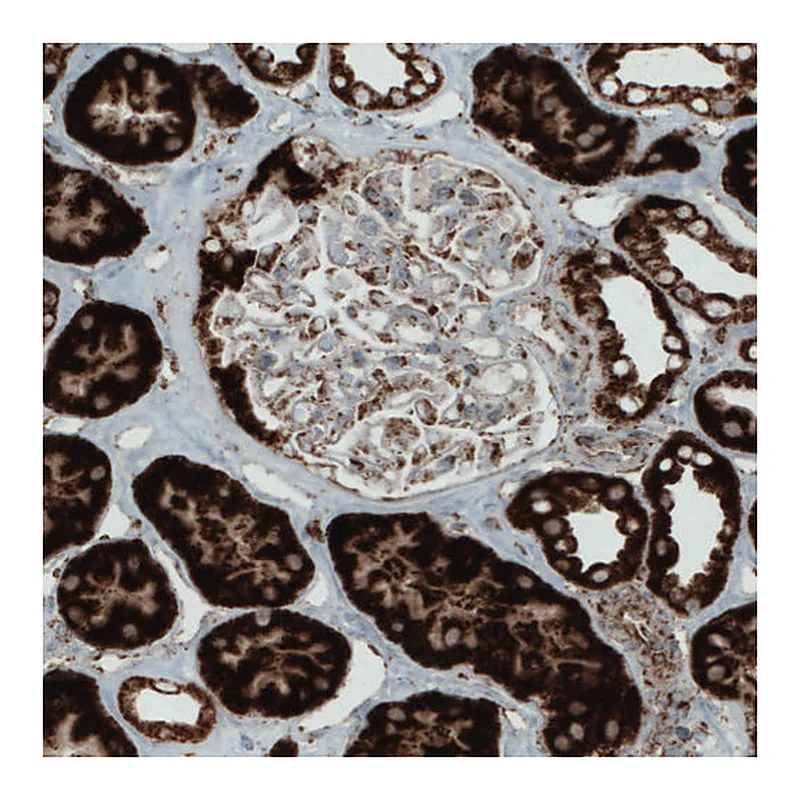 Atlas Antibodies Anti-SDHB Antibody