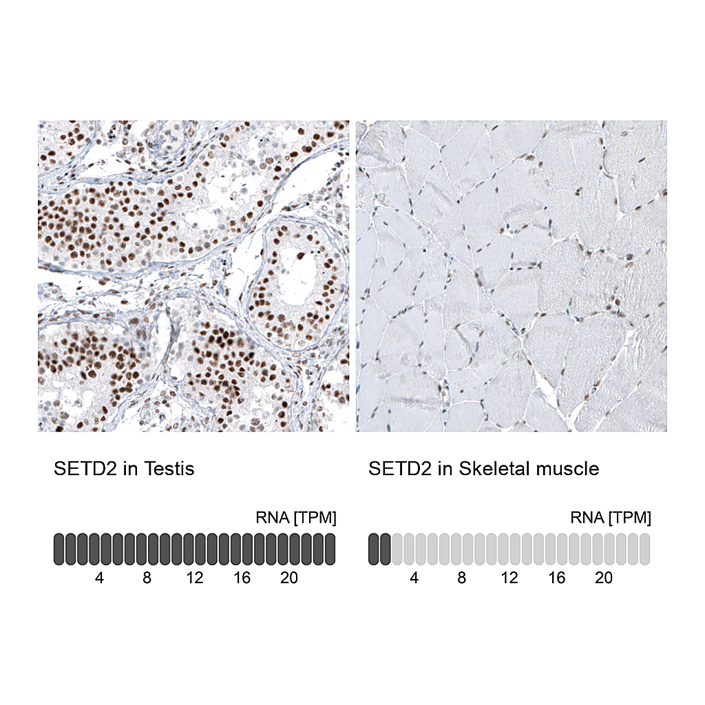 Atlas Antibodies Anti-SETD2 Antibody