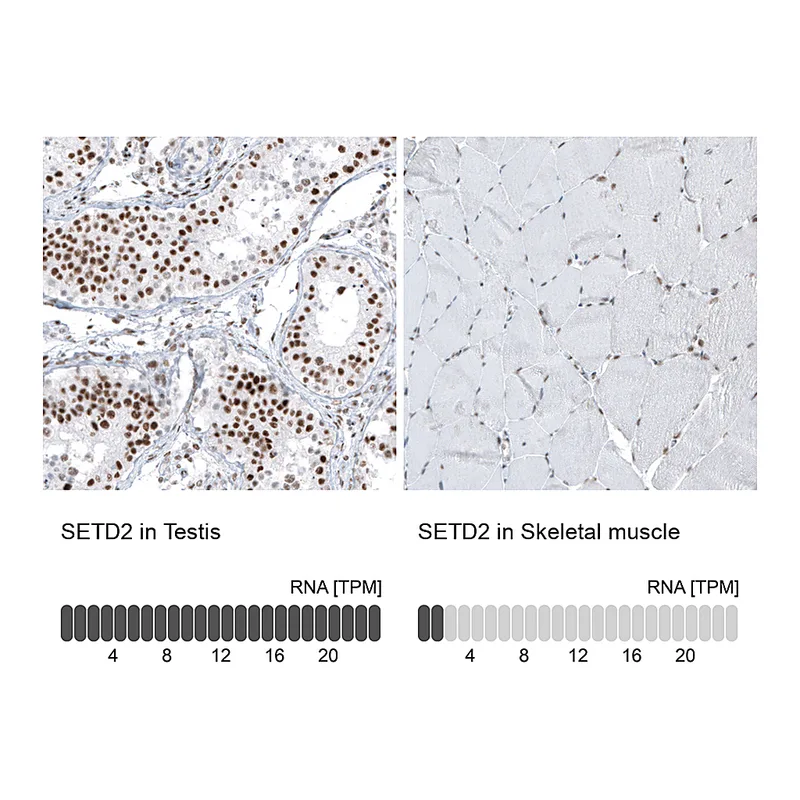 Atlas Antibodies Anti-SETD2 Antibody