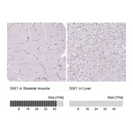 Atlas Antibodies Anti-SIX1 Antibody