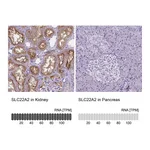 Atlas Antibodies Anti-SLC22A2 Antibody