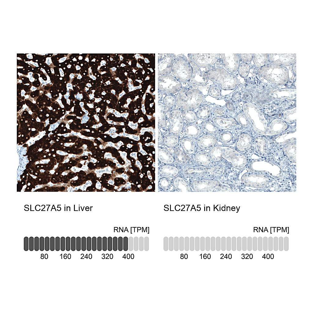 Atlas Antibodies Anti-SLC27A5 Antibody