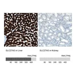 Atlas Antibodies Anti-SLC27A5 Antibody