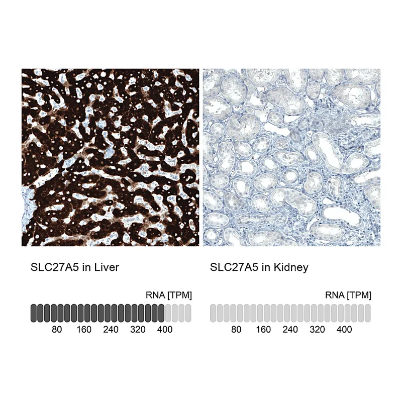 Atlas Antibodies Anti-SLC27A5 Antibody