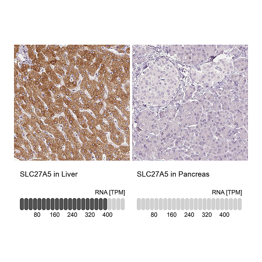 Atlas Antibodies Anti-SLC27A5 Antibody