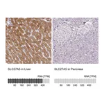 Atlas Antibodies Anti-SLC27A5 Antibody