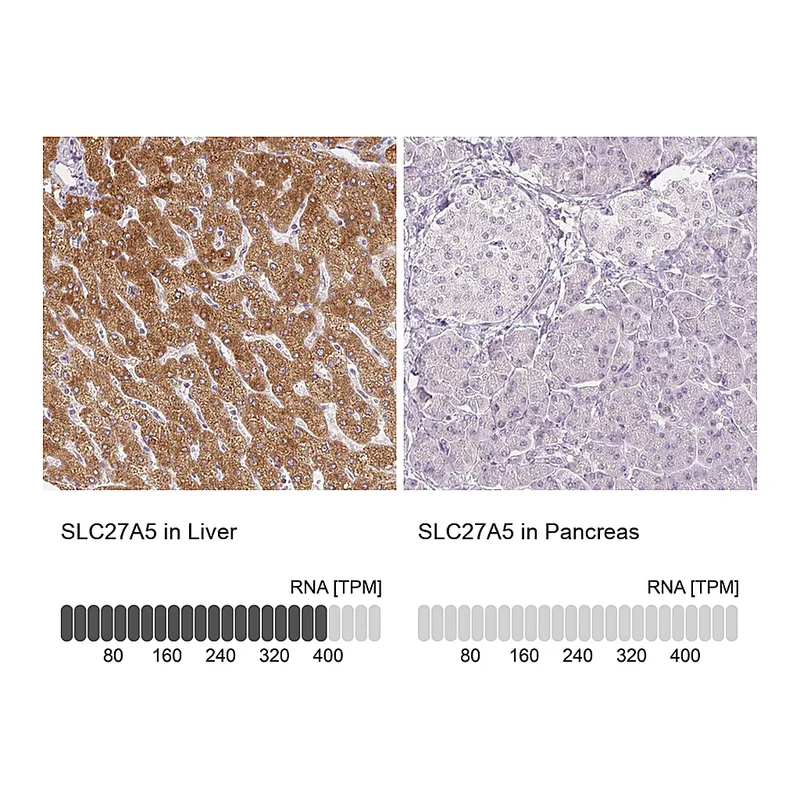 Atlas Antibodies Anti-SLC27A5 Antibody