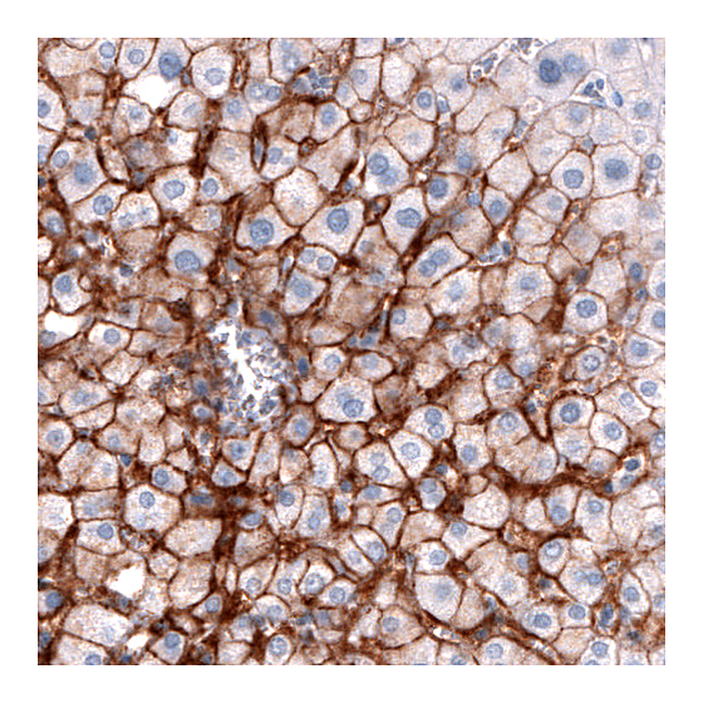 Atlas Antibodies Anti-SLCO1B3 Antibody