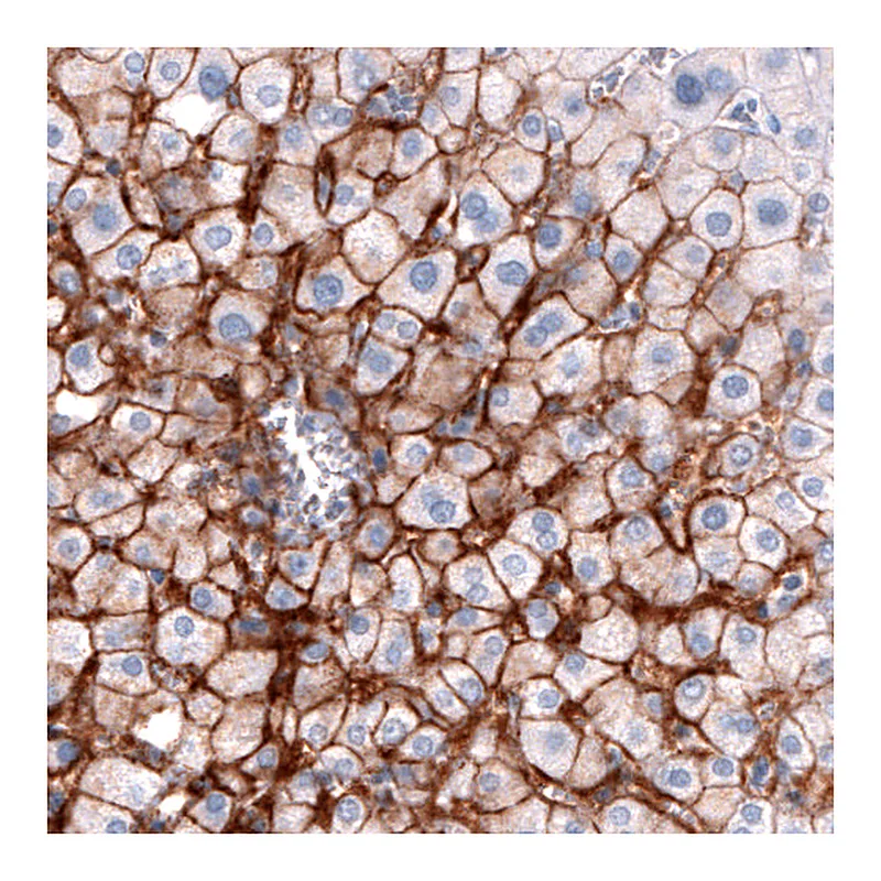Atlas Antibodies Anti-SLCO1B3 Antibody