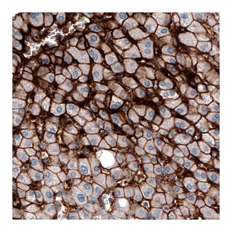 Atlas Antibodies Anti-SLCO1B3 Antibody