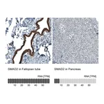 Atlas Antibodies Anti-SMAD2 Antibody