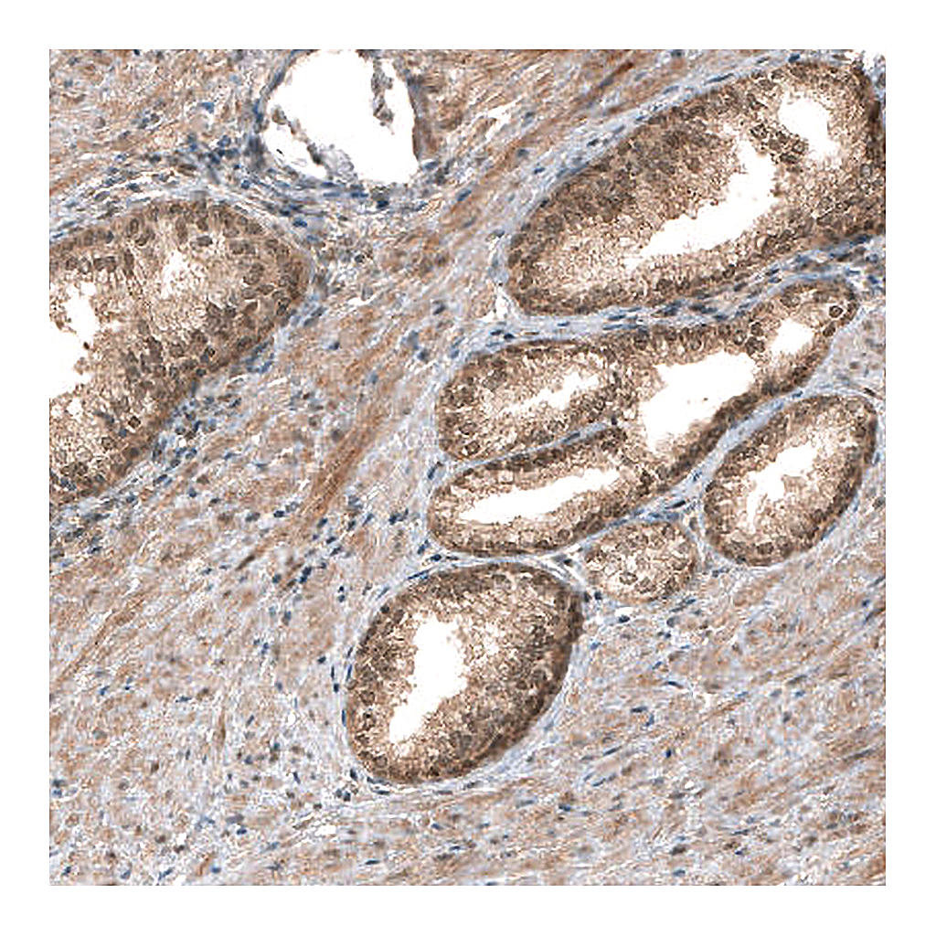 Atlas Antibodies Anti-SMAD4 Antibody