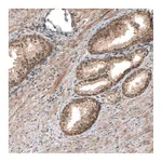 Atlas Antibodies Anti-SMAD4 Antibody