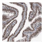 Atlas Antibodies Anti-SMCHD1 Antibody