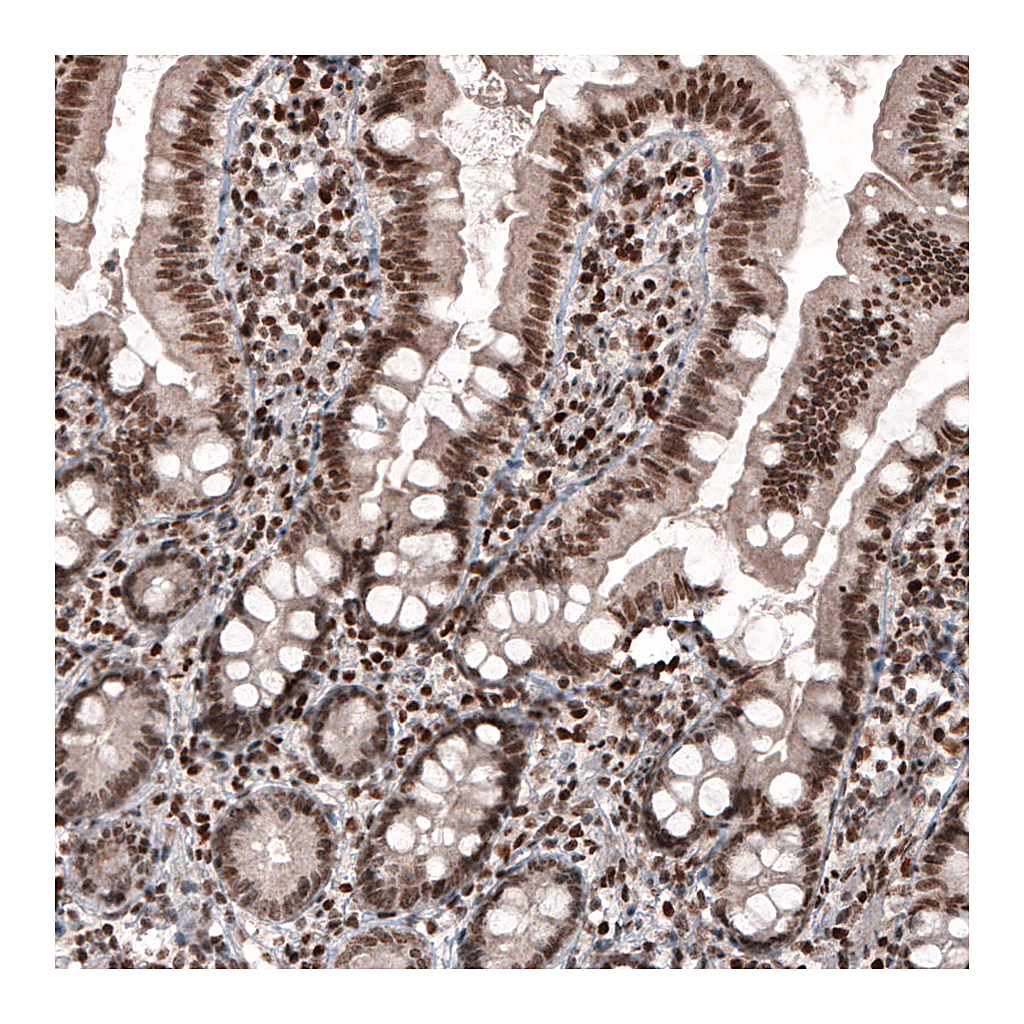 Atlas Antibodies Anti-SMCHD1 Antibody