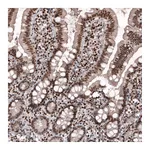 Atlas Antibodies Anti-SMCHD1 Antibody