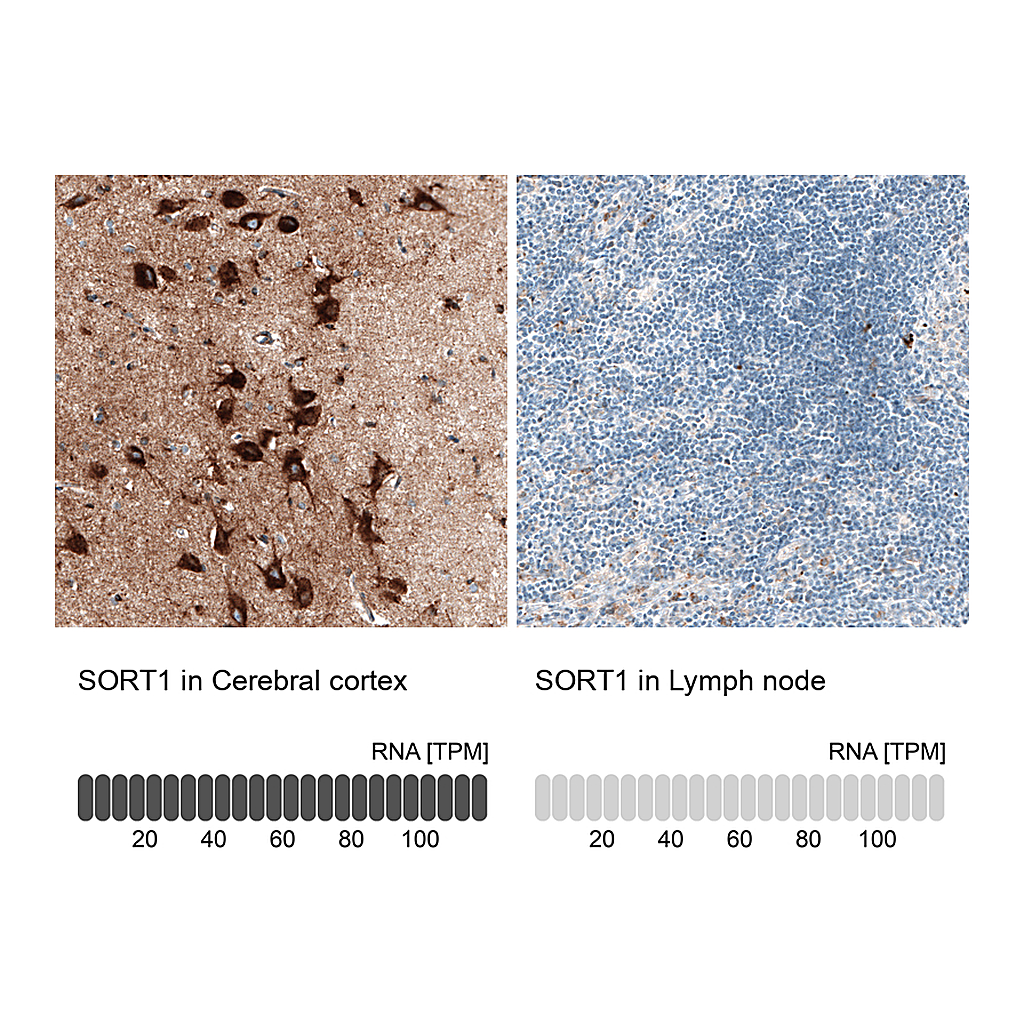 Atlas Antibodies Anti-SORT1 Antibody