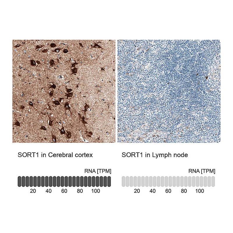 Atlas Antibodies Anti-SORT1 Antibody