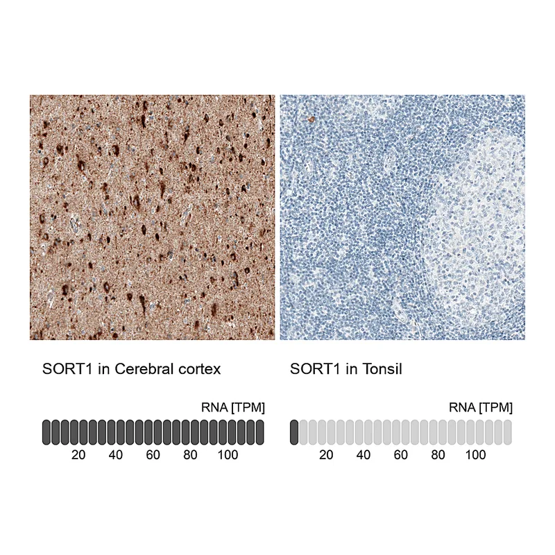 Atlas Antibodies Anti-SORT1 Antibody