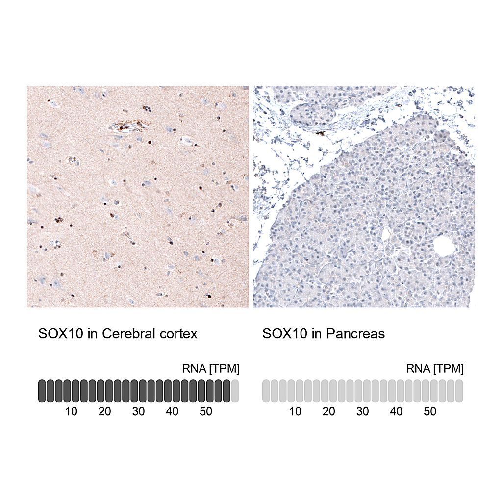 Atlas Antibodies Anti-SOX10 Antibody