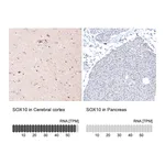 Atlas Antibodies Anti-SOX10 Antibody