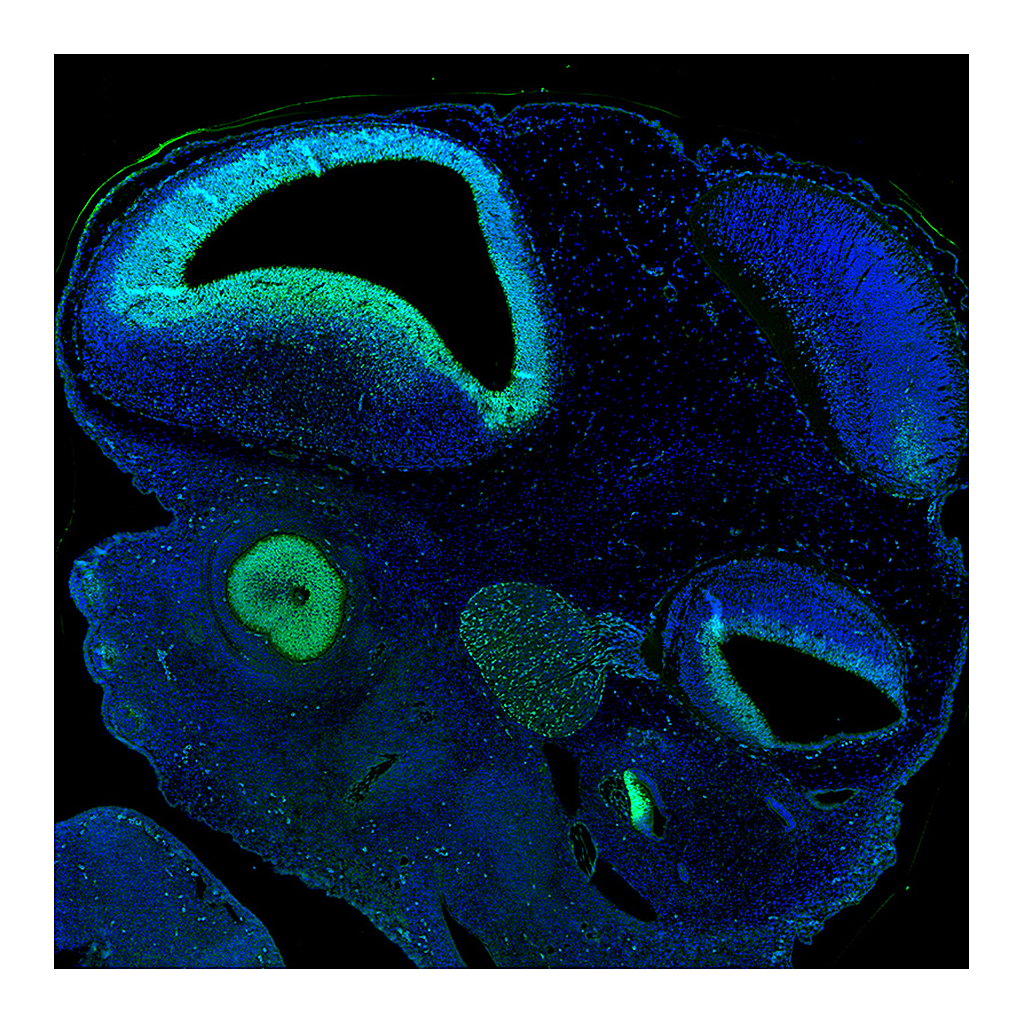 Atlas Antibodies Anti-SOX2 Antibody