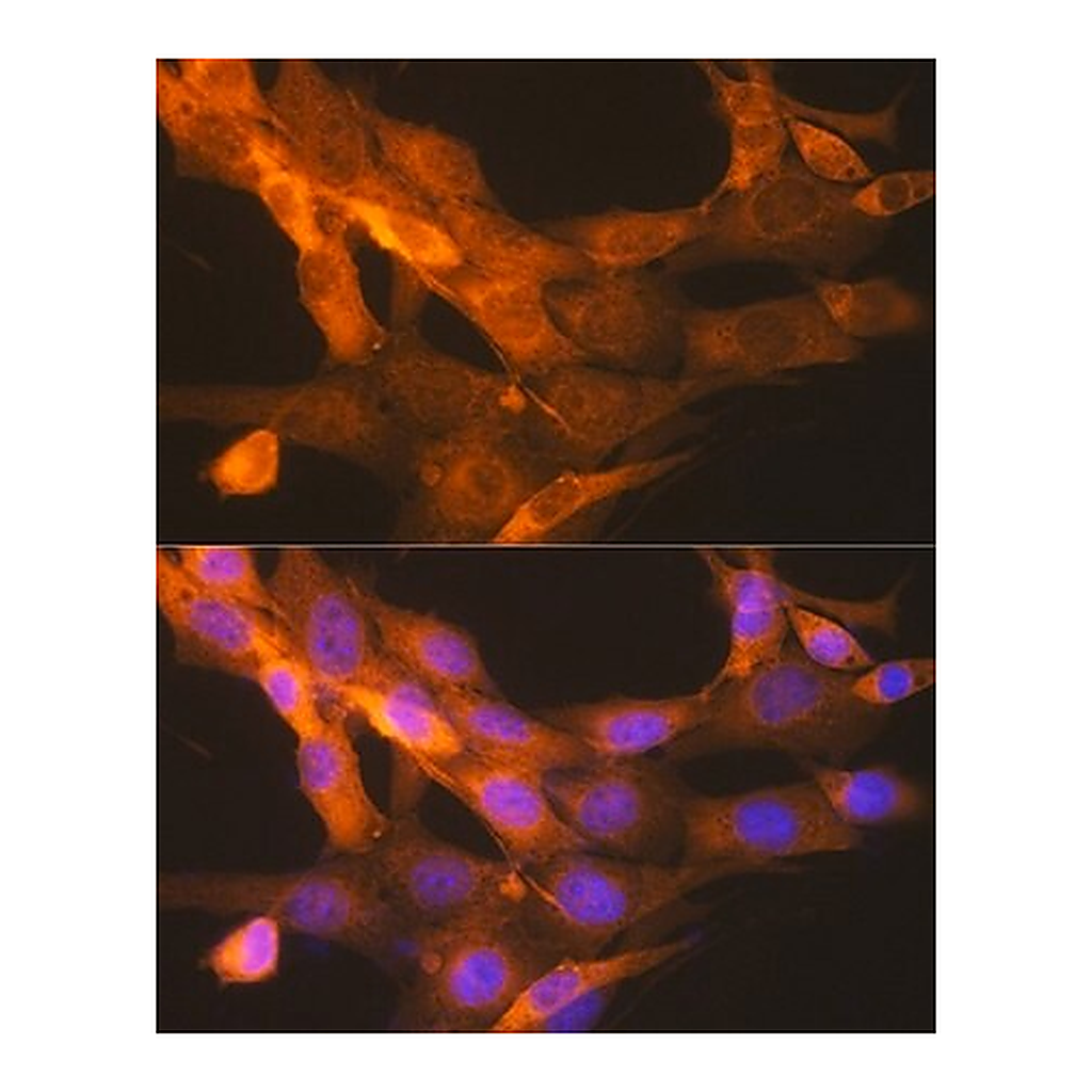 Merck Anti-tPA/PLAT antibody produced in rabbit