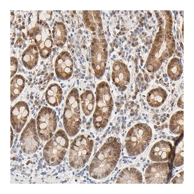 Merck Anti-ACSS2 antibody produced in rabbit