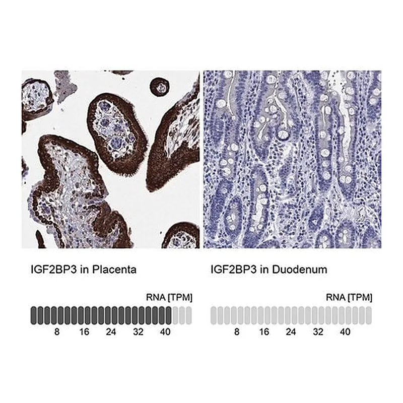 Merck Anti-IGF2BP3 antibody produced in rabbit