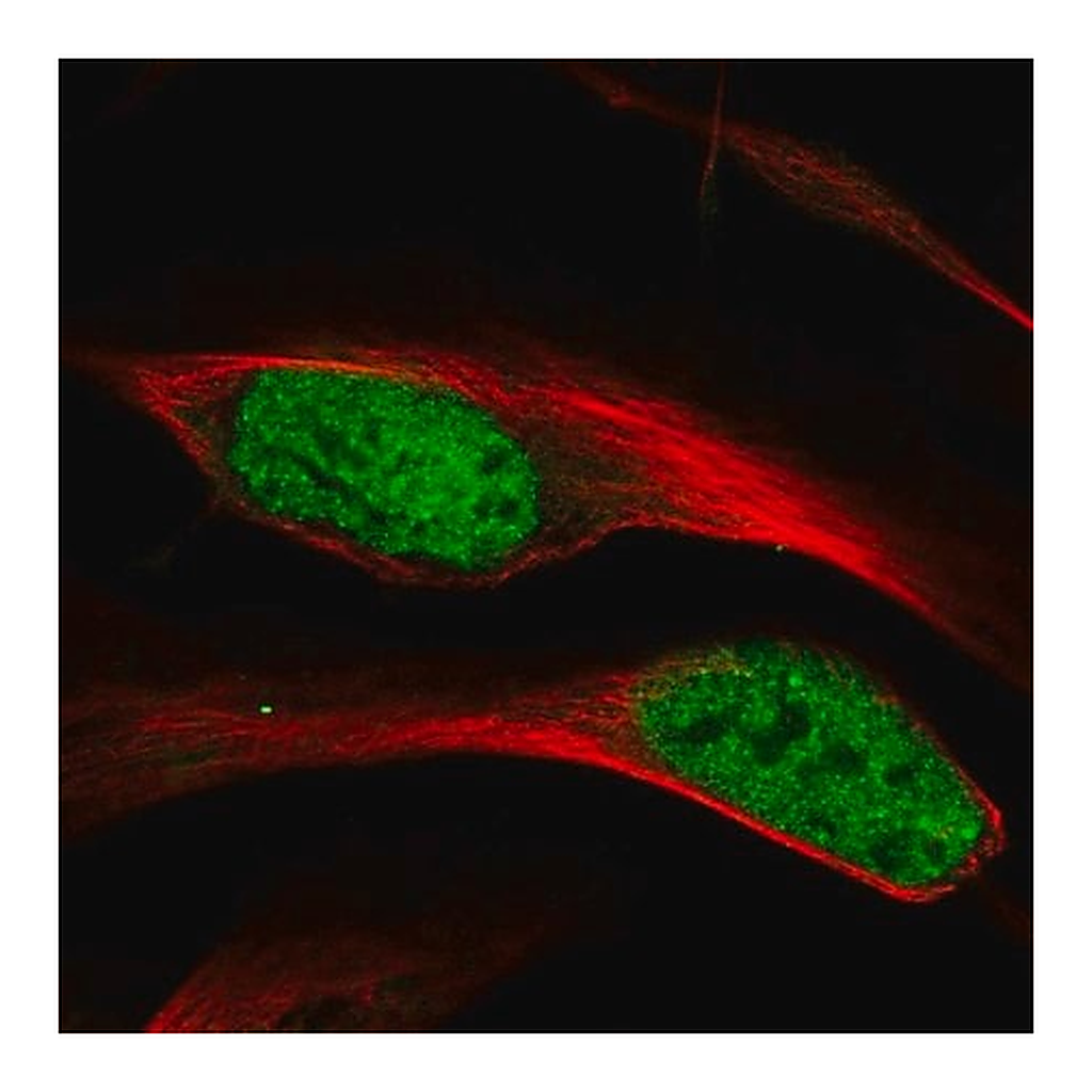 Merck Anti-HNRNPA1 antibody produced in rabbit