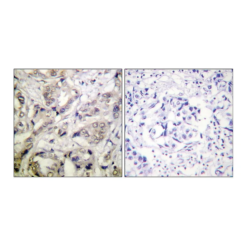 Merck Anti-CAMK1-alpha antibody produced in rabbit