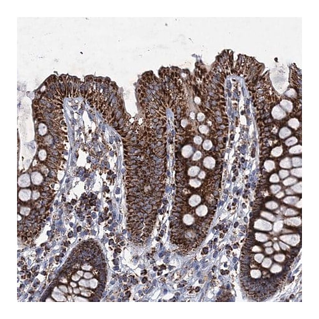 Merck Anti-GTPBP3 antibody produced in rabbit